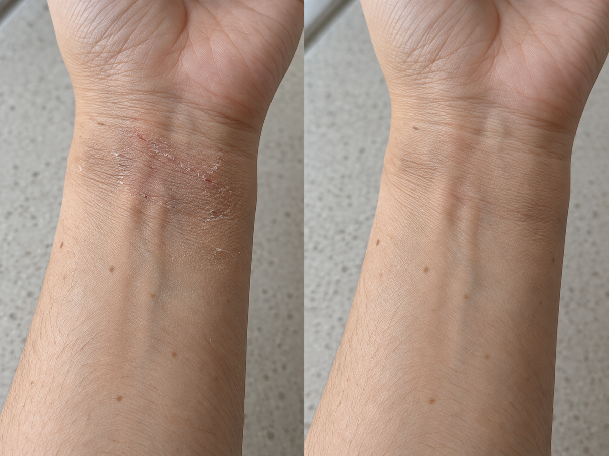Close-up illustration of wrist skin in two care states